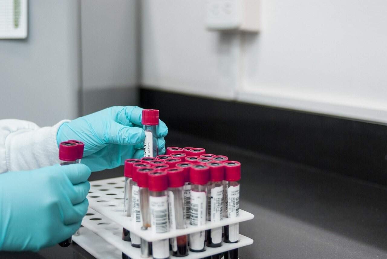 Manos con guantes azules manipulando tubos de ensayo según las directrices de la OMS para el uso de guantes en laboratorio- Uso Correcto de Guantes OMS